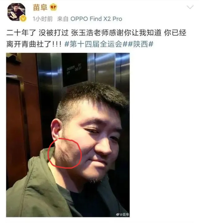 苗阜發(fā)微自爆被打后秒刪,打人者張玉浩發(fā)微“因果有循環(huán)” 相聲新勢力 青曲社 相聲 張玉浩 苗阜 3030說  第1張 苗阜發(fā)微自爆被打后秒刪,打人者張玉浩發(fā)微“因果有循環(huán)” 相聲新勢力 青曲社 相聲 張玉浩 苗阜 3030說  第1張